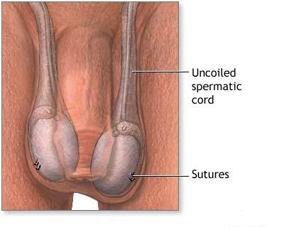 Afectiunile testiculare si prostatice